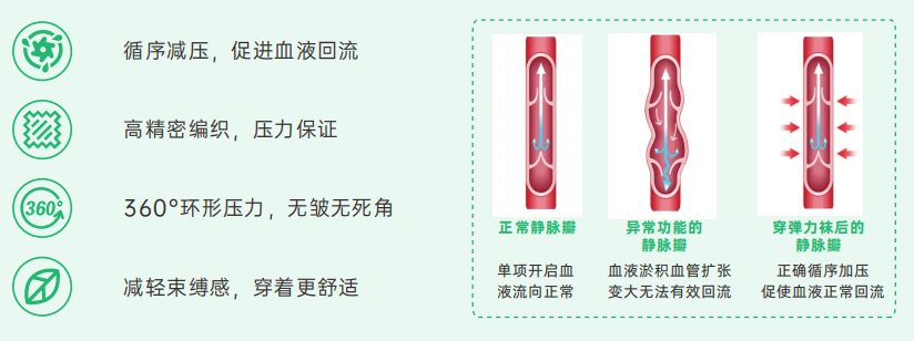 靜脈曲張?jiān)撊绾晤A(yù)防？